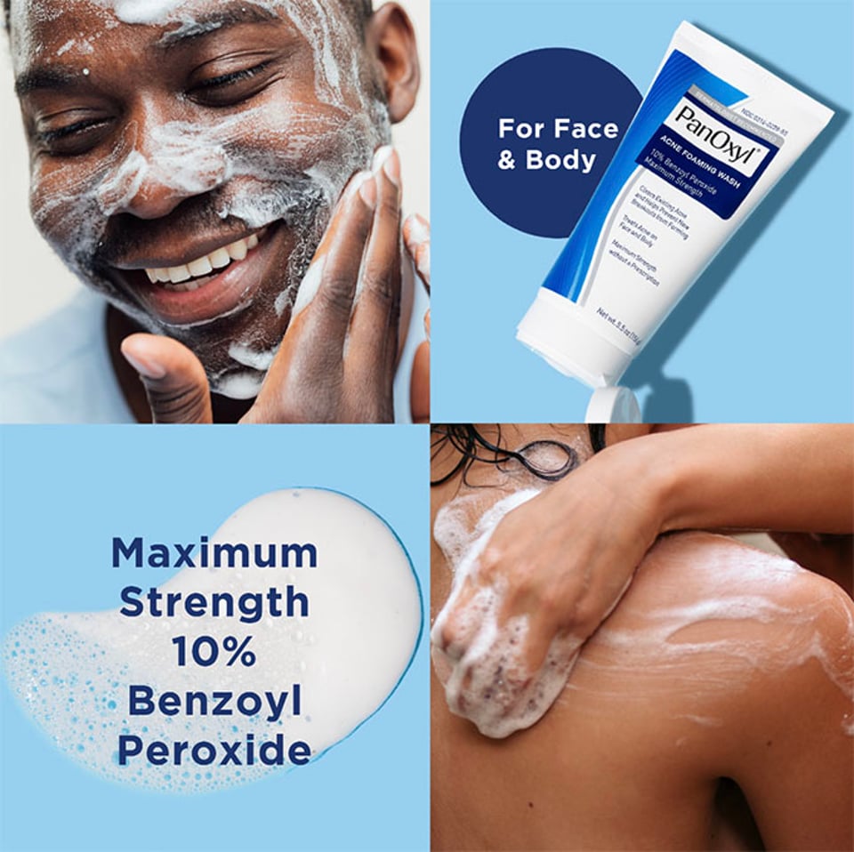 PanOxyl Acne Foaming Wash 170g